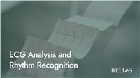 ECG Analysis and Rhythm Recognition