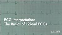 ECG Interpretation: The Basics of 12-Lead ECGs