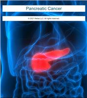 Pancreatic Cancer