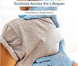 Scoliosis Across the Lifespan