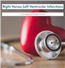 Right Versus Left Ventricular Myocardial Infarctions