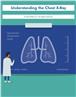 Understanding the Chest X-Ray